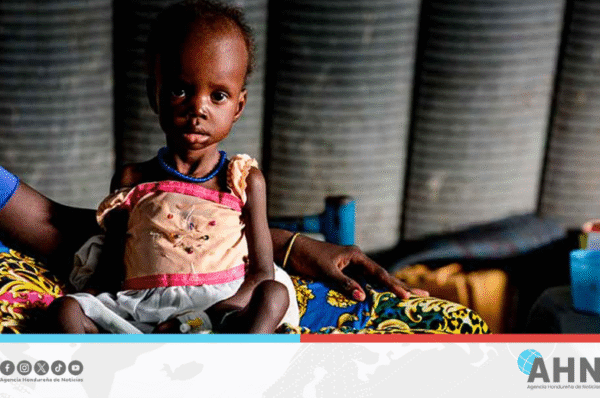 Aumentan casos de desnutrición aguda en niños sudaneses según Unicef