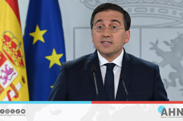 Ministro español condena hambruna en Gaza denunciada por organismos internacionales