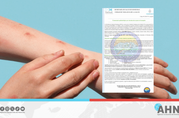 Honduras emite alerta sanitaria por riesgo de introducción del sarampión