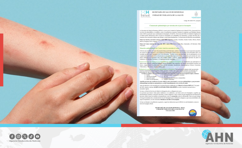 Honduras emite alerta sanitaria por riesgo de introducción del sarampión